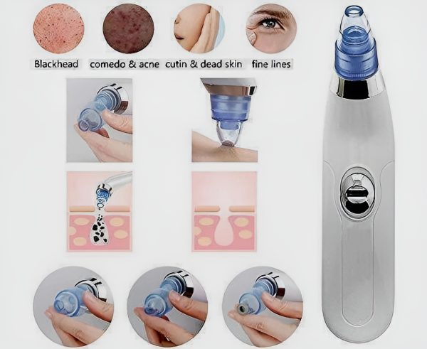 Black Head Remover - Derma Suction Nose Cleaner - Electric Pore Vacuum Cleaner for Deep Facial Cleansing & Skin Care